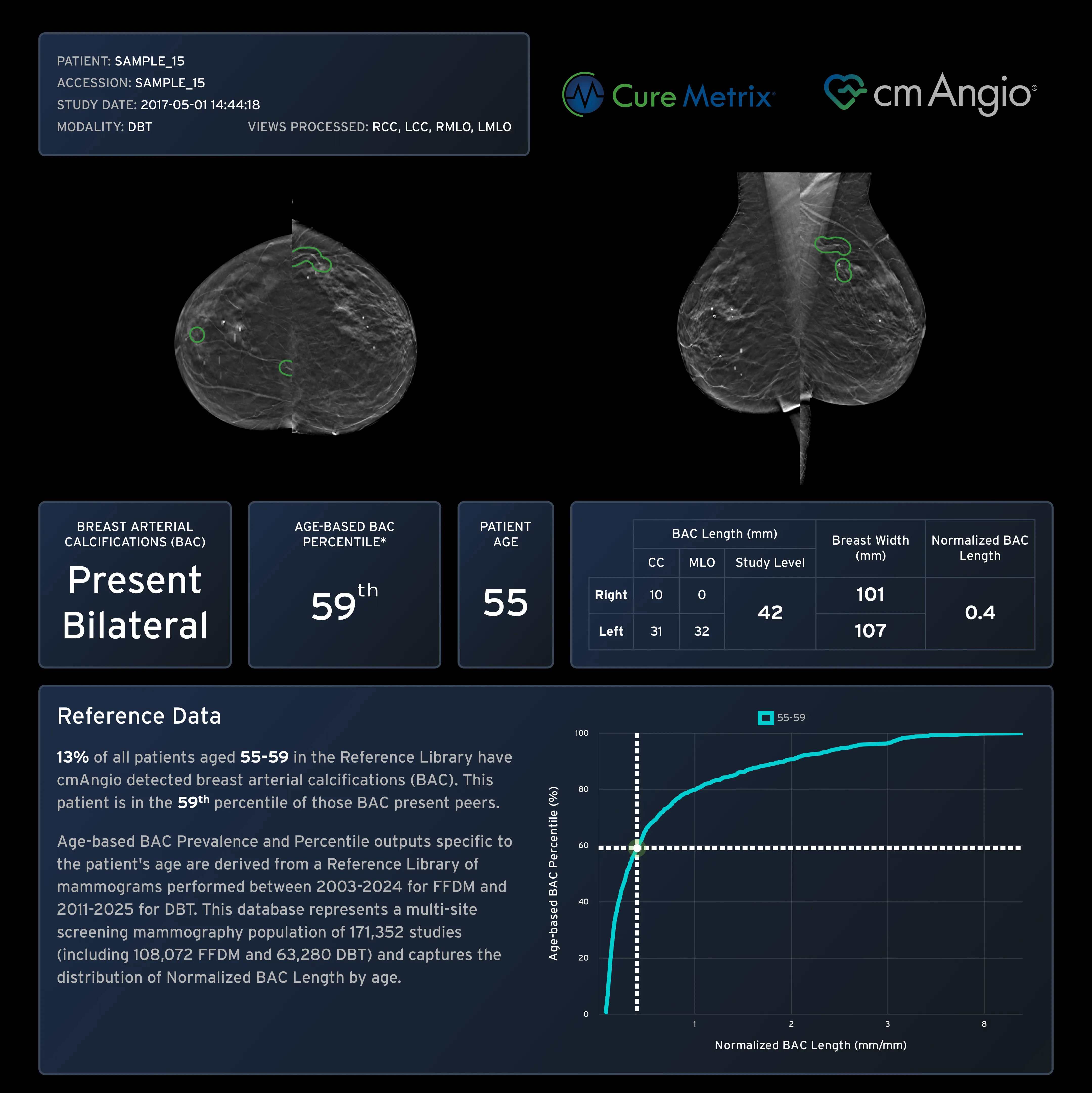cmAngio V2.0 Scorecard — Present Bilateral, 59th Percentile