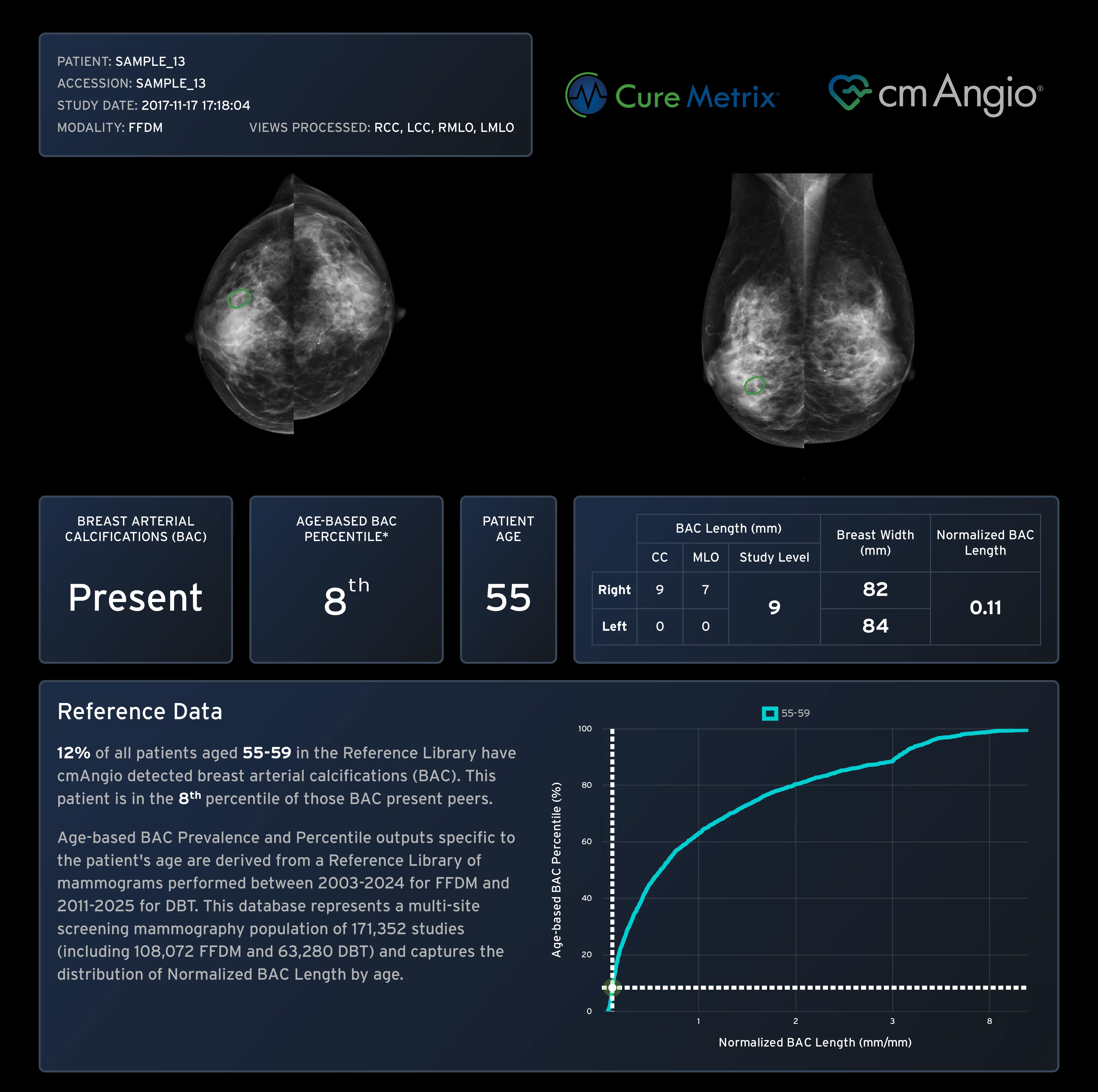 cmAngio V2.0 Scorecard — Present, 8th Percentile