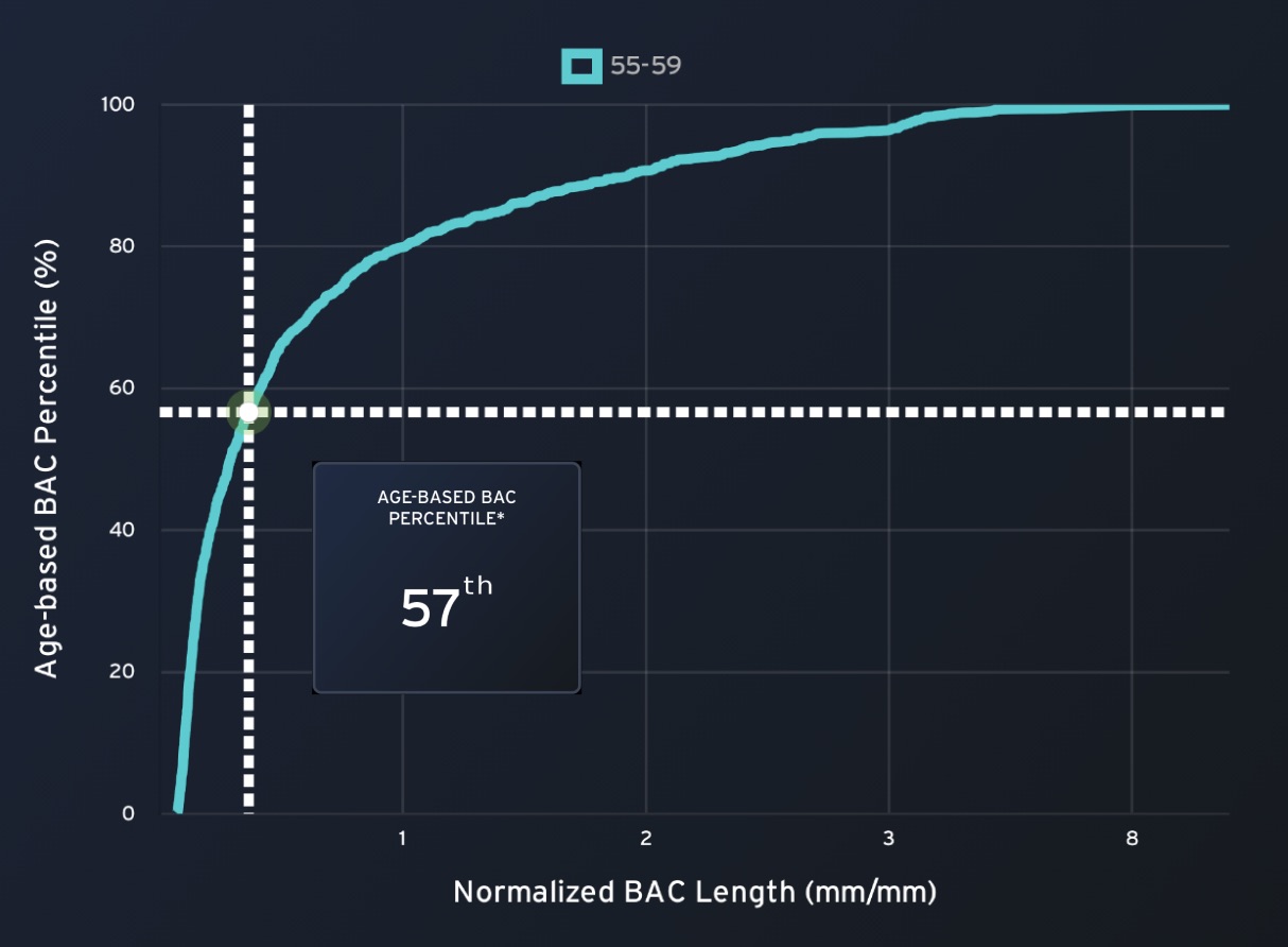 cmAngio Contextualize — Age-Based Percentile & Prevalence graph from CureMetrix Reference Library